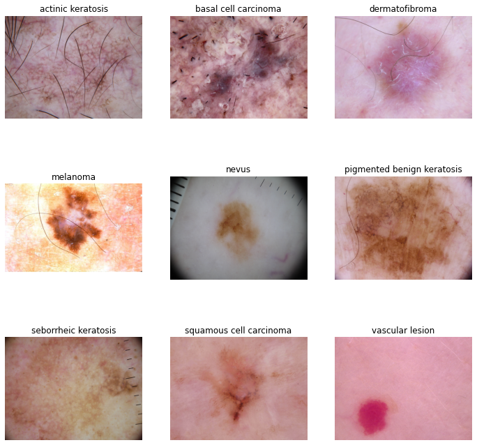 Skin Cancer CNN